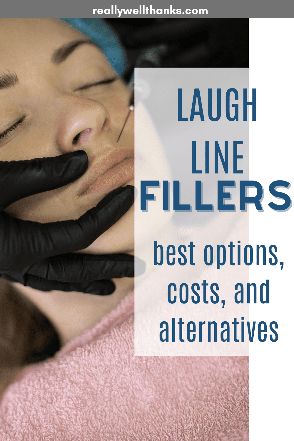 Best Filler for Wrinkles Around the Mouth – Worry-Free Smile