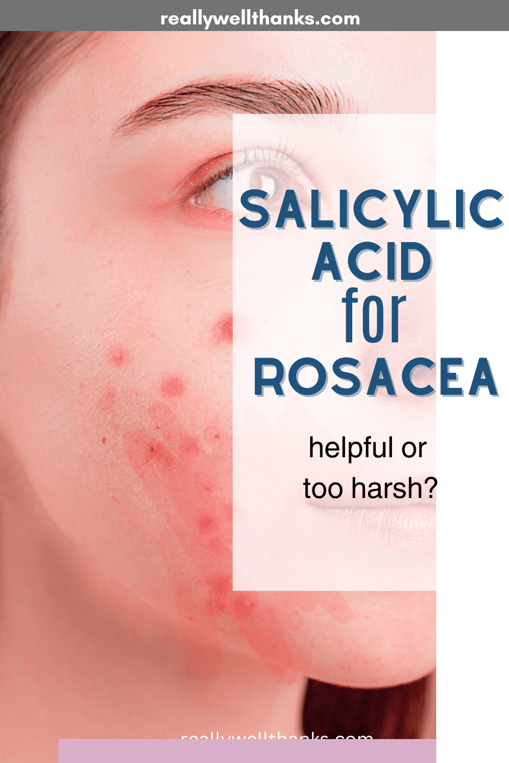 is salicylic acid good for rosacea pin